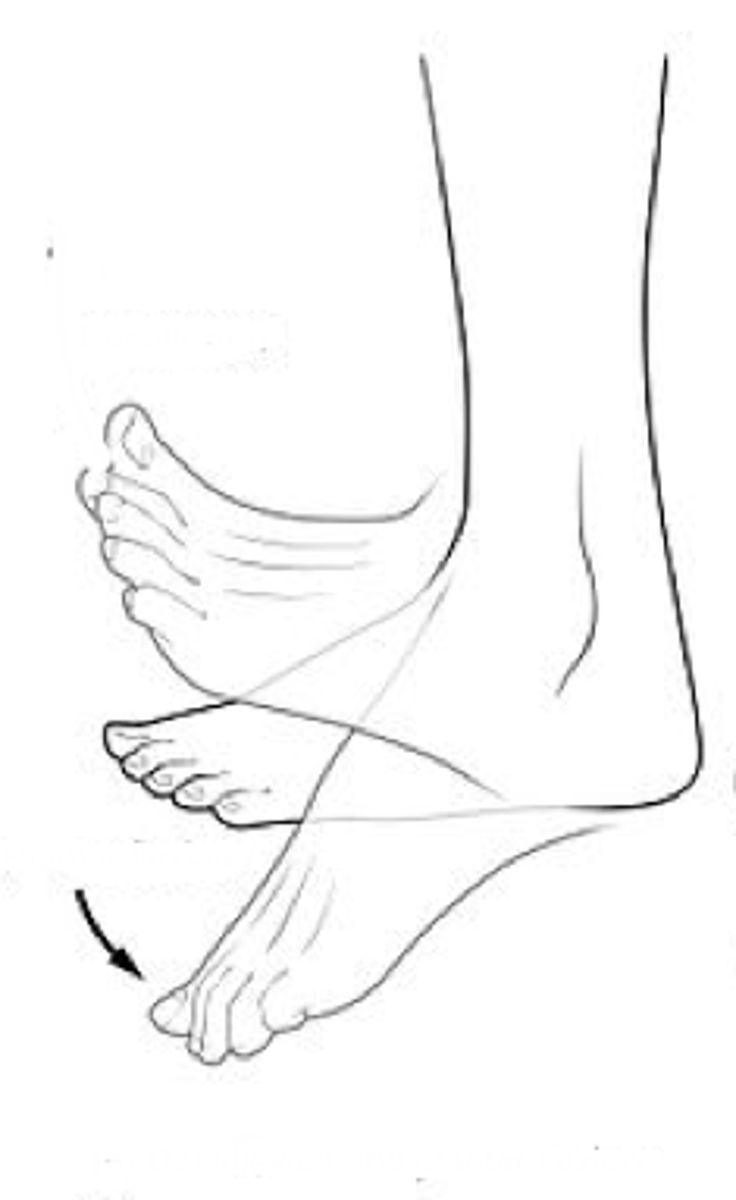 <p>Identify the action indicated in "B"</p>