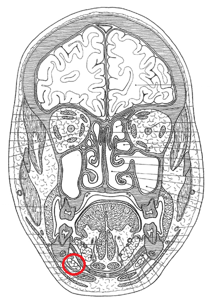 term image