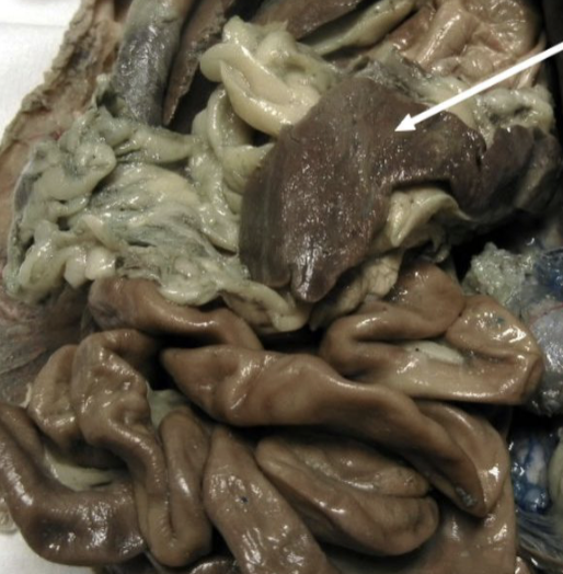 <p><strong>white line </strong></p>