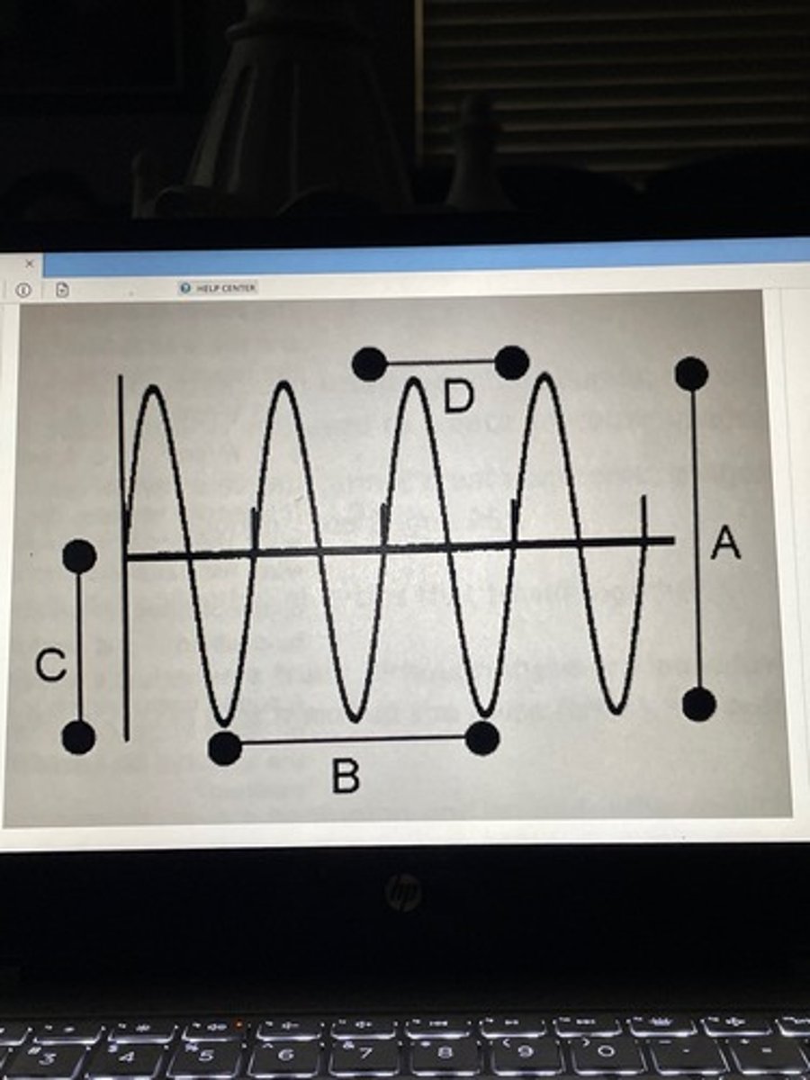 <p>What of the following best describes line D?</p>