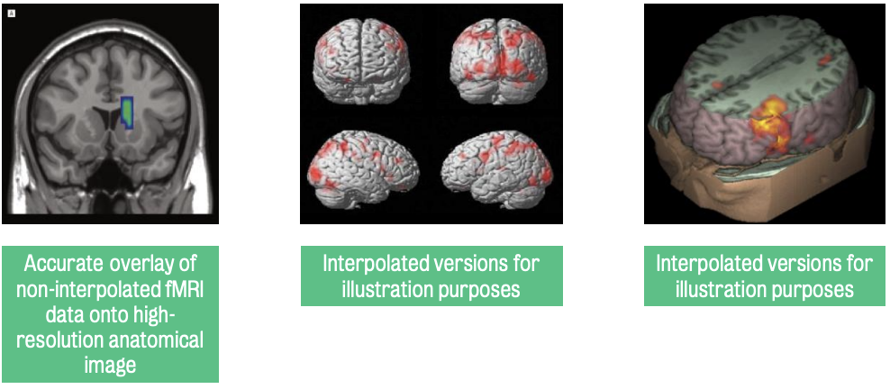Visual representation of 'prettification' of results in neuroscience