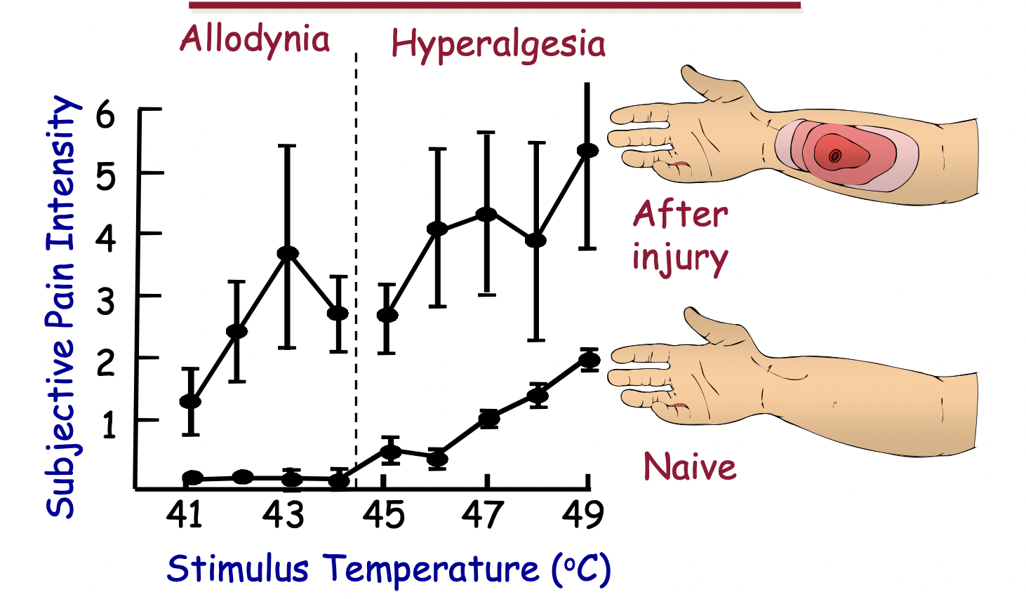 <p>perception of pain from a normally non-painful stimulus</p>