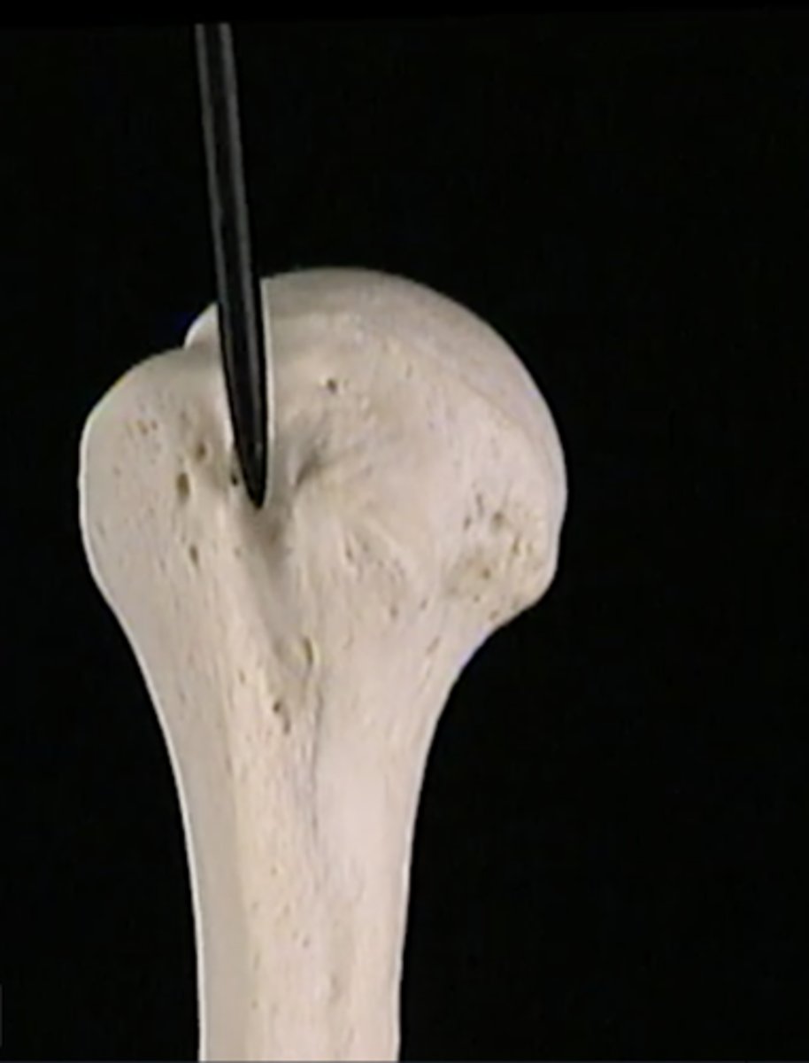 <p>a narrow channel between the two tubercles</p>