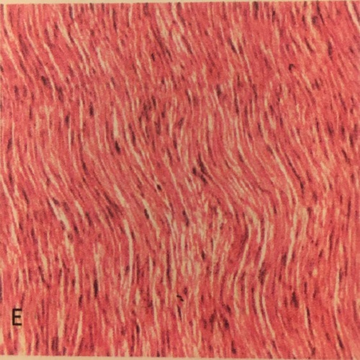 <p>ligaments in the vocal folds and between the vertebrae</p>