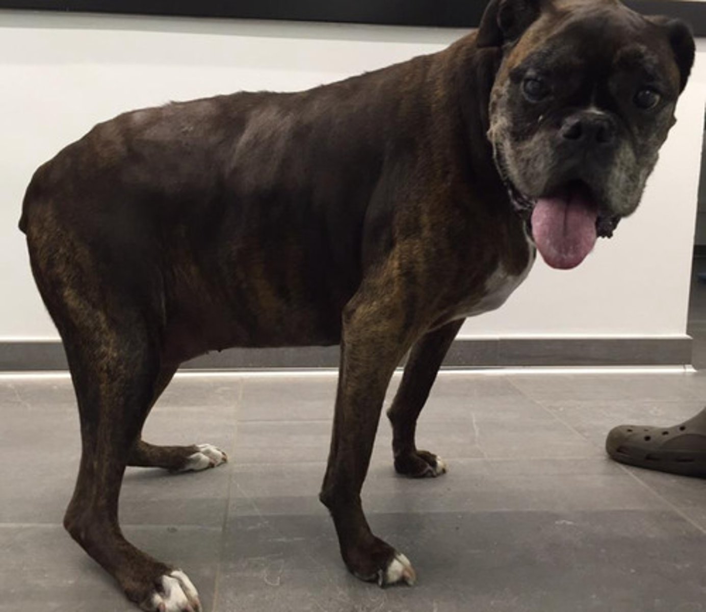 <p>Which one describes an achilles tendon rupture?</p><p>A. Proximal origin of achilles tendon complex</p><p>B. Rupture at myotendinous junction</p><p>C. Laceration thorugh tendon only</p><p>D. Avusion at calcaneous</p><p>E. All of the above</p>