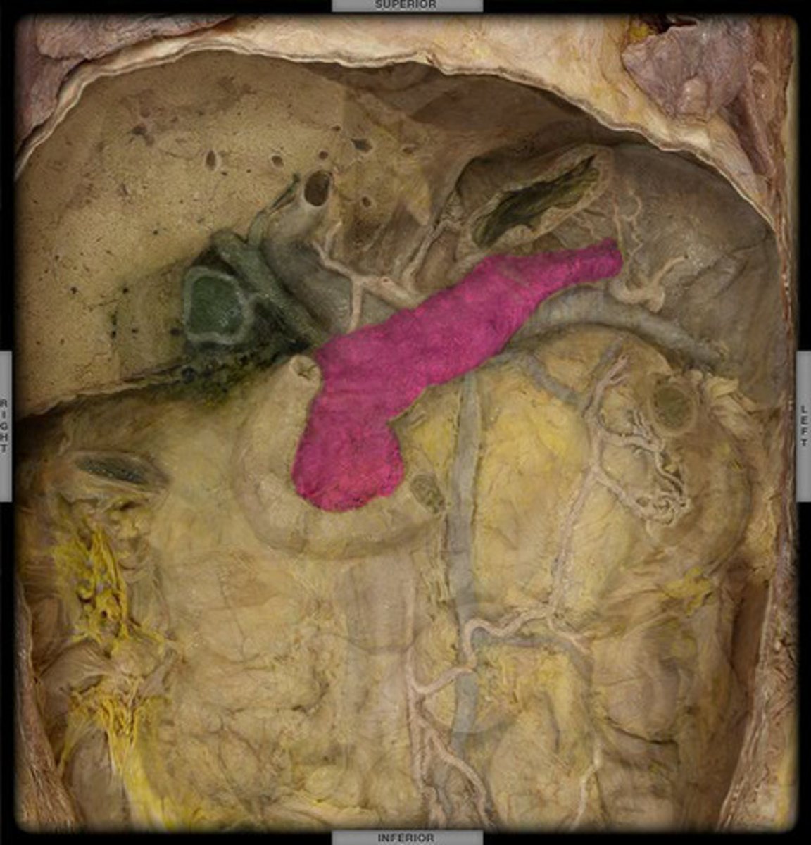 <p>A triangular organ that lies between the stomach and first part of the small intestine.</p>