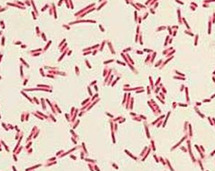 Gram negative, rod shaped, common in digestive tract of mammals, model organism, transmitted by fecal-oral route