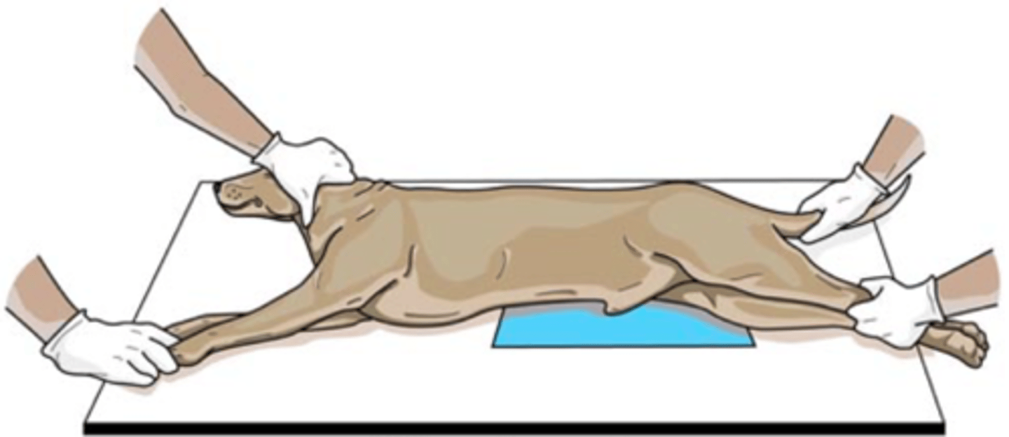 <p>Patient laying on side (right/left refers to side that is touching the table)</p>