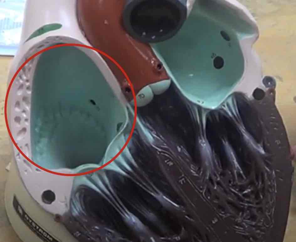 <p>what is this? (giant heart model)</p>