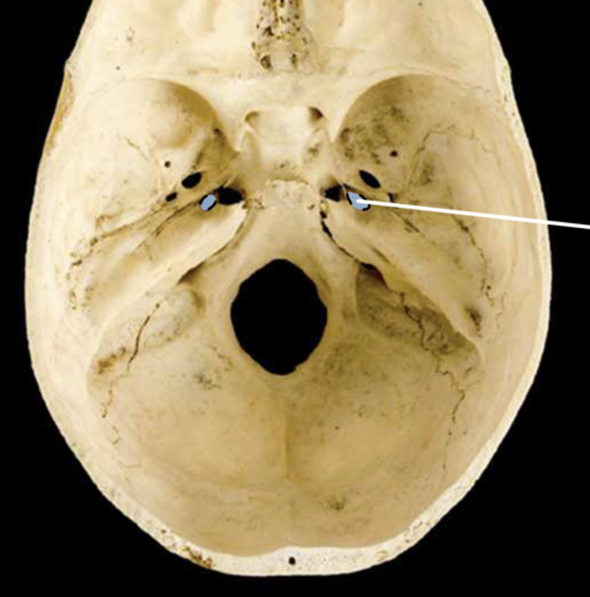 <p>passageway for internal carotid artery</p>