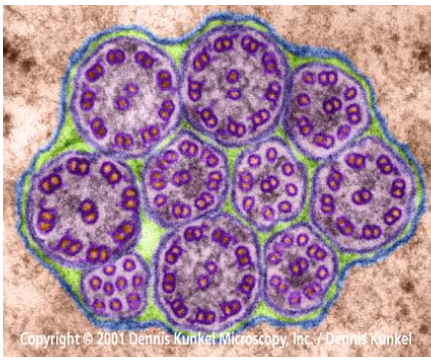 <p>Cilia (remember 9+2 organization)</p>