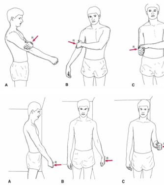 <p>Multiple angle muscle setting exercise on R/L shoulder x 6sH x 10 reps x 3 sets to develop strong, mobile tissues</p>