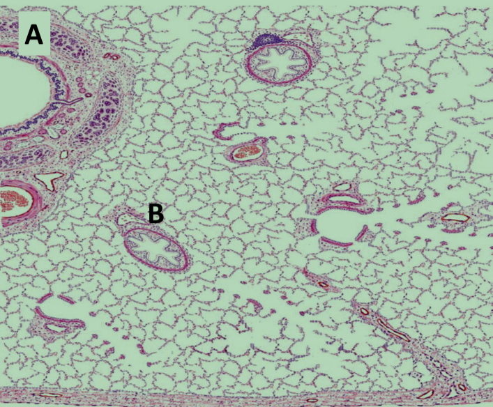 <p>What is structure A in the same lung diagram?</p>