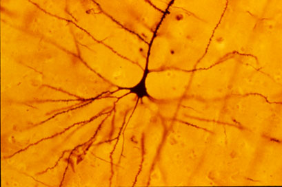 <p>neurons with pyramidal shape in cortex</p>