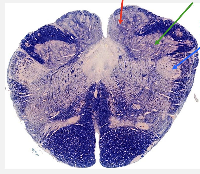 <p>caudal medulla cross section structures </p>