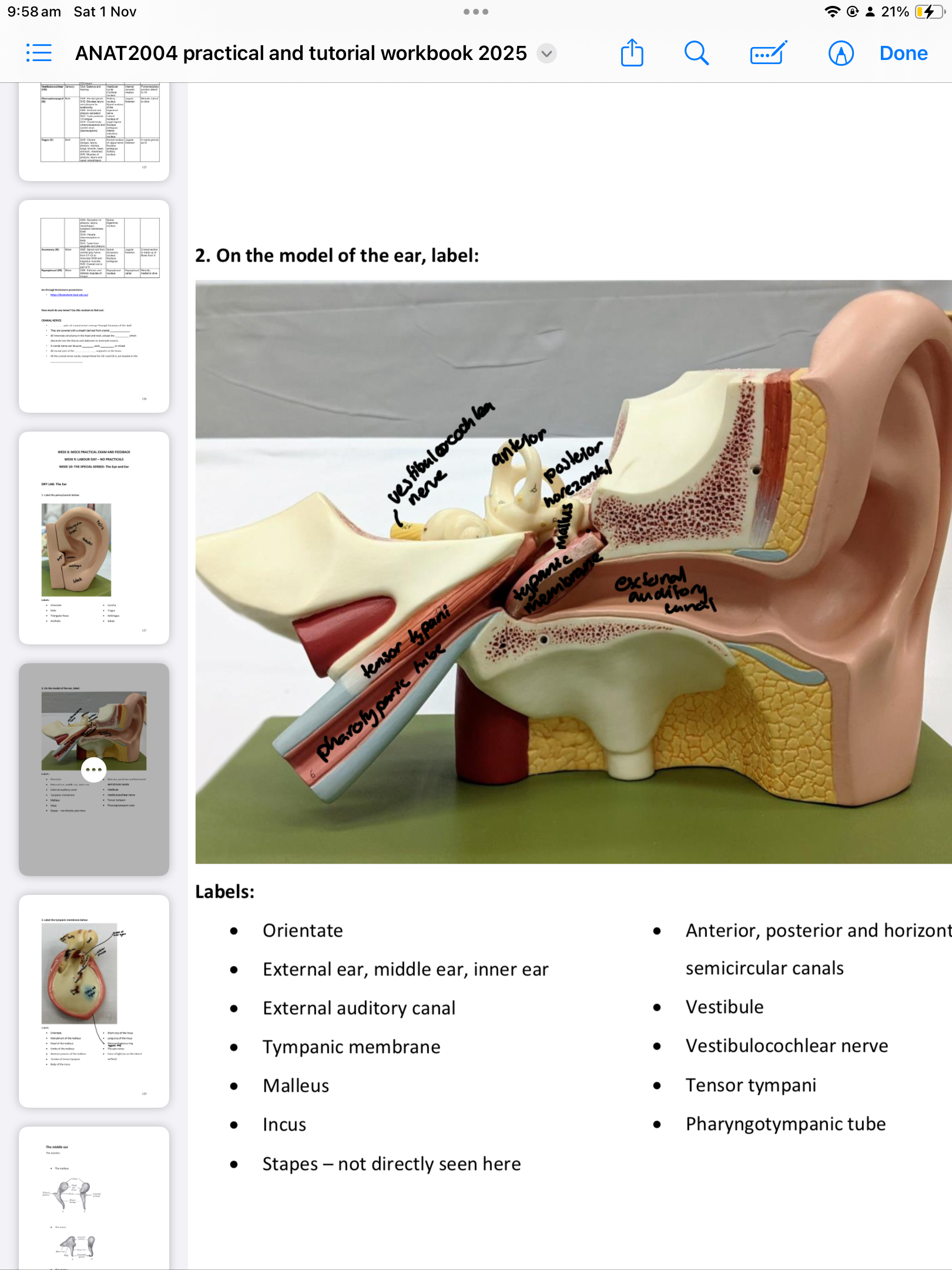 <ul><li><p>External auditory canal </p></li><li><p>Tympanic membrane </p></li><li><p>Malleus &amp; Incus </p></li><li><p>Horizontal semicircular canals </p></li><li><p>Vestibule </p></li><li><p>Vestibulocochlear nerve </p></li><li><p>Tensor tympani </p></li><li><p>Pharyngotympanic tube</p></li></ul><p></p>