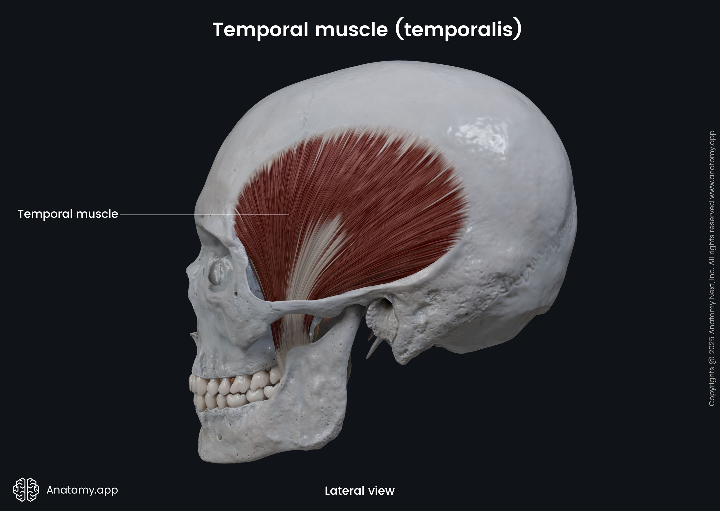 <p><strong>Temporalis </strong></p>