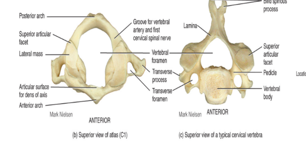 <ul><li><p>there are 7 vertebrae found within the cervical region: C<sub>1</sub>-C<sub>7</sub></p><ul><li><p>these are the smallest and the lightest weight vertebrae (delicate)</p></li></ul></li><li><p>C<sub>1 </sub>is the atlas</p><ul><li><p>has no body (very delicate)</p></li><li><p>has no spinous process (allows for head to move “yes”)</p></li><li><p>the absence of these joints allow you to move your head up and down in a yes motion</p></li><li><p><mark data-color="blue" style="background-color: blue; color: inherit">articulates superiorly with occipital condyle</mark></p></li></ul></li></ul><p></p>