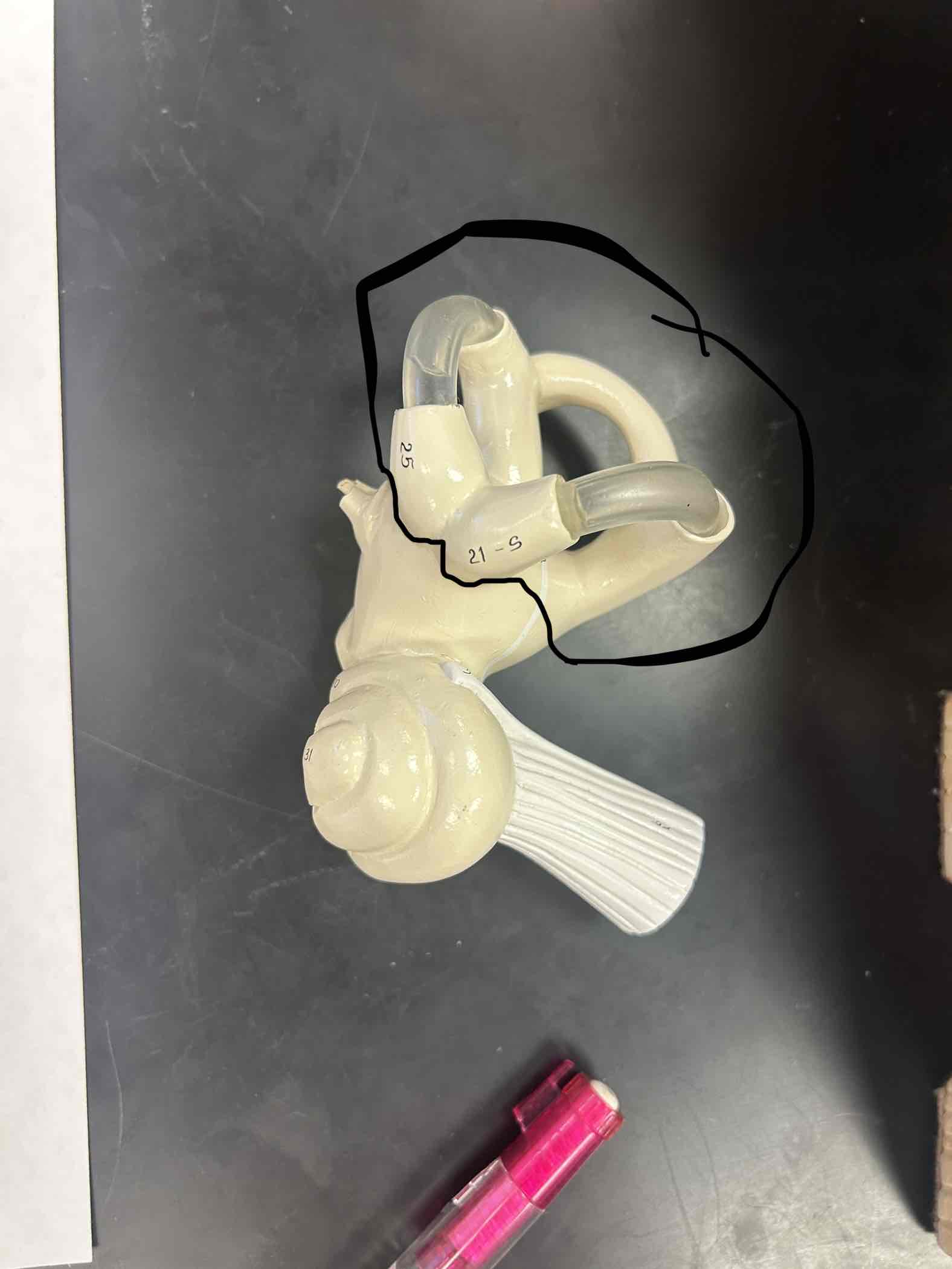 <p>3 lopes of the inner ear</p>