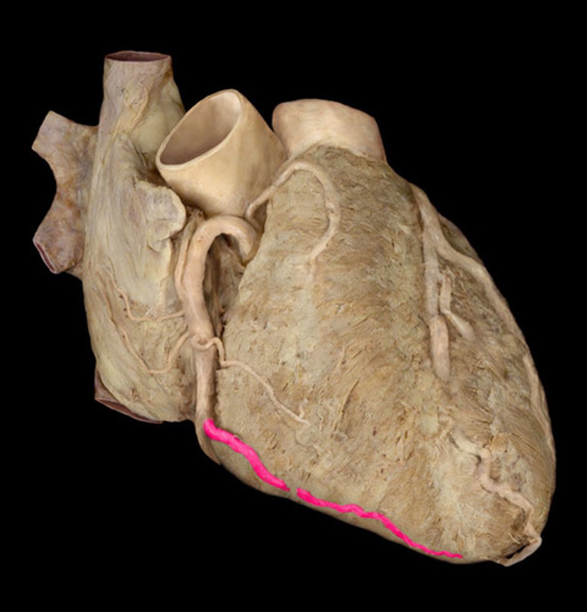 <p>right coronary artery branch</p>