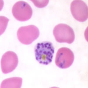 late schizont Plasmodium vivax