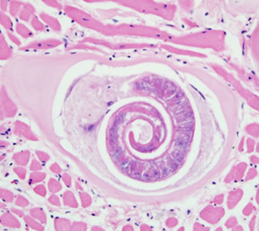<p>trichinella spiralis</p>
