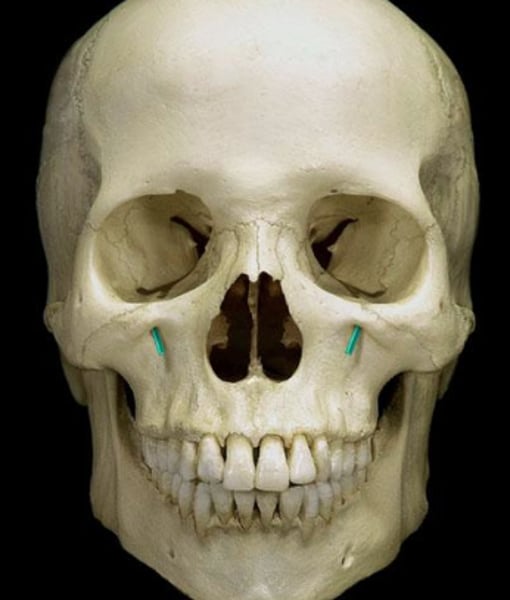 <p>infraorbital nerve</p>