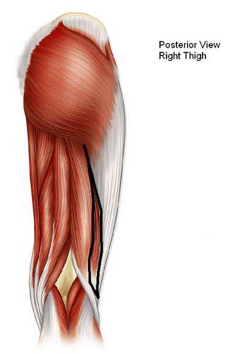 <p>Identify the Muscle. </p>