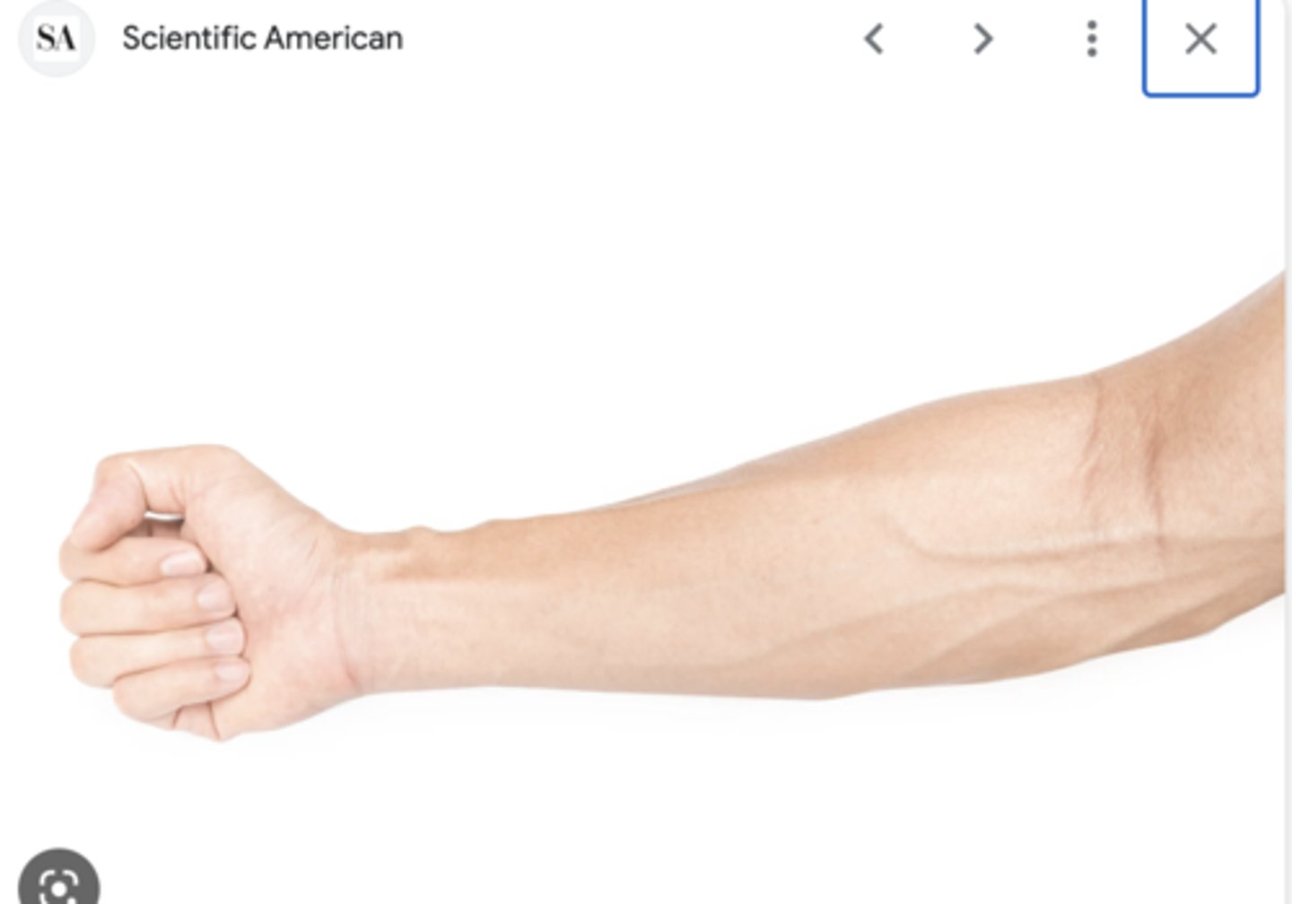 <p>the forearm subregions</p>