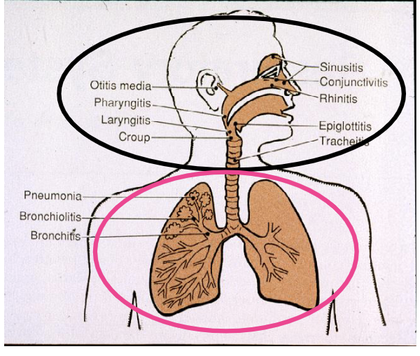 <ol><li><p>upper respiratory infections (URIs)</p></li><li><p>lower respiratory infections (LRIs)</p></li></ol><p></p>