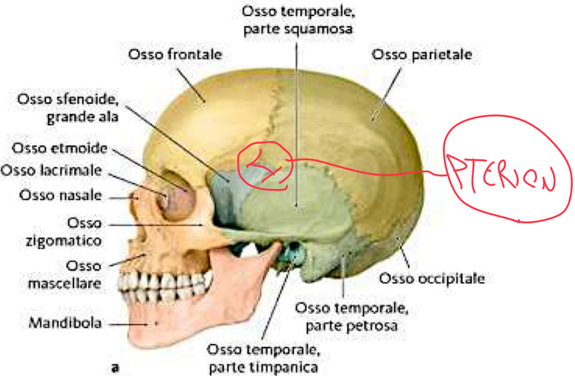 <p>Regione di incontro a forma di H tra:</p><ul><li><p>Osso Frontale</p></li><li><p>Osso Parietale</p></li><li><p>Osso Temporale </p></li><li><p>Grande ala dello Sfenoide</p></li></ul><p>Clinicamente importante perché:</p><ul><li><p>Parete ossea molto sottile al di sotto della quale decorre il ramo anteriore dell’arteria meningea media</p></li><li><p>Un trauma qui può causare ematoma epidurale. </p></li></ul><p></p>