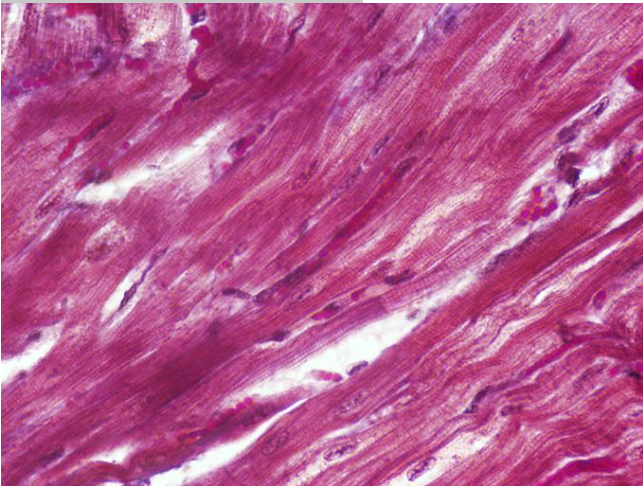 <p><span>Identify the type of muscle tissue shown?</span></p>