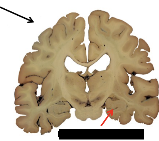 <p><strong>limbic system</strong></p><ul><li><p>what structure is this?</p></li></ul><p></p>