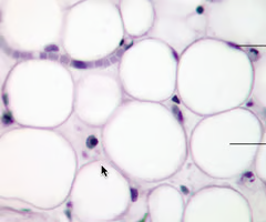 <p>closely packed adipocytes; acts as storage depts for fat with little cellular matrix</p><ul><li><p>rapid <strong>storage mobilization of lipid molecules</strong></p></li><li><p>cushion and protection</p></li><li><p>found cushioning around the <strong>kidneys</strong> and back of the eye</p></li></ul><p></p>