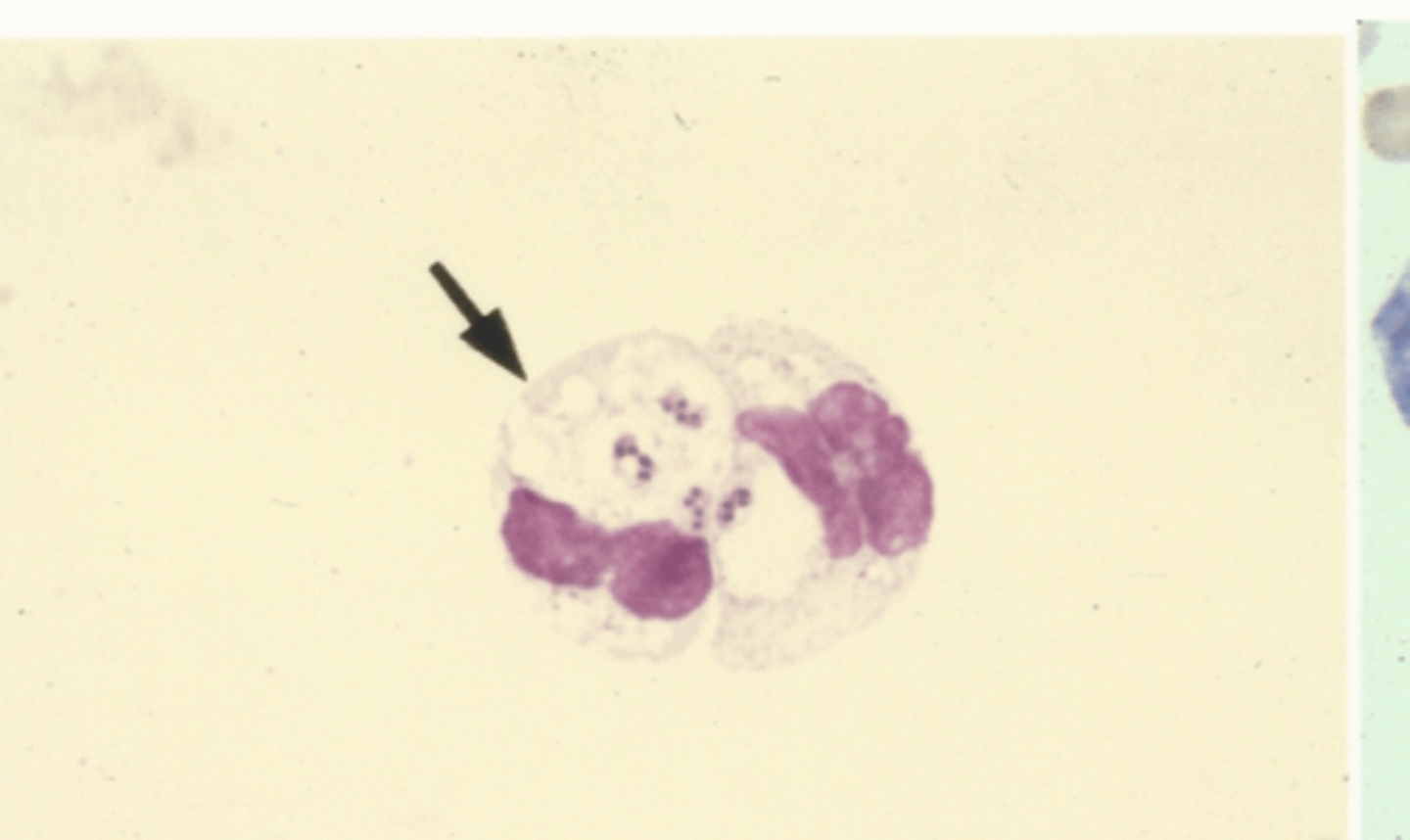 <p>Identify the cells in this body fluid</p>