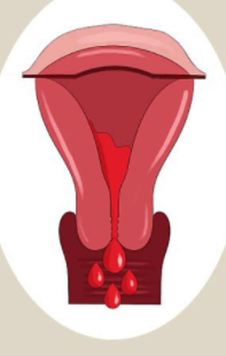 <p>Menstruation</p>