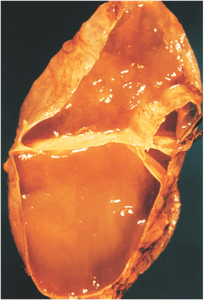 <p>Identify the pathology</p>