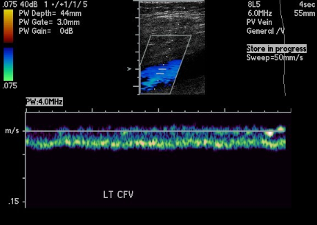 <p><span>This waveform indicates&nbsp;</span></p>