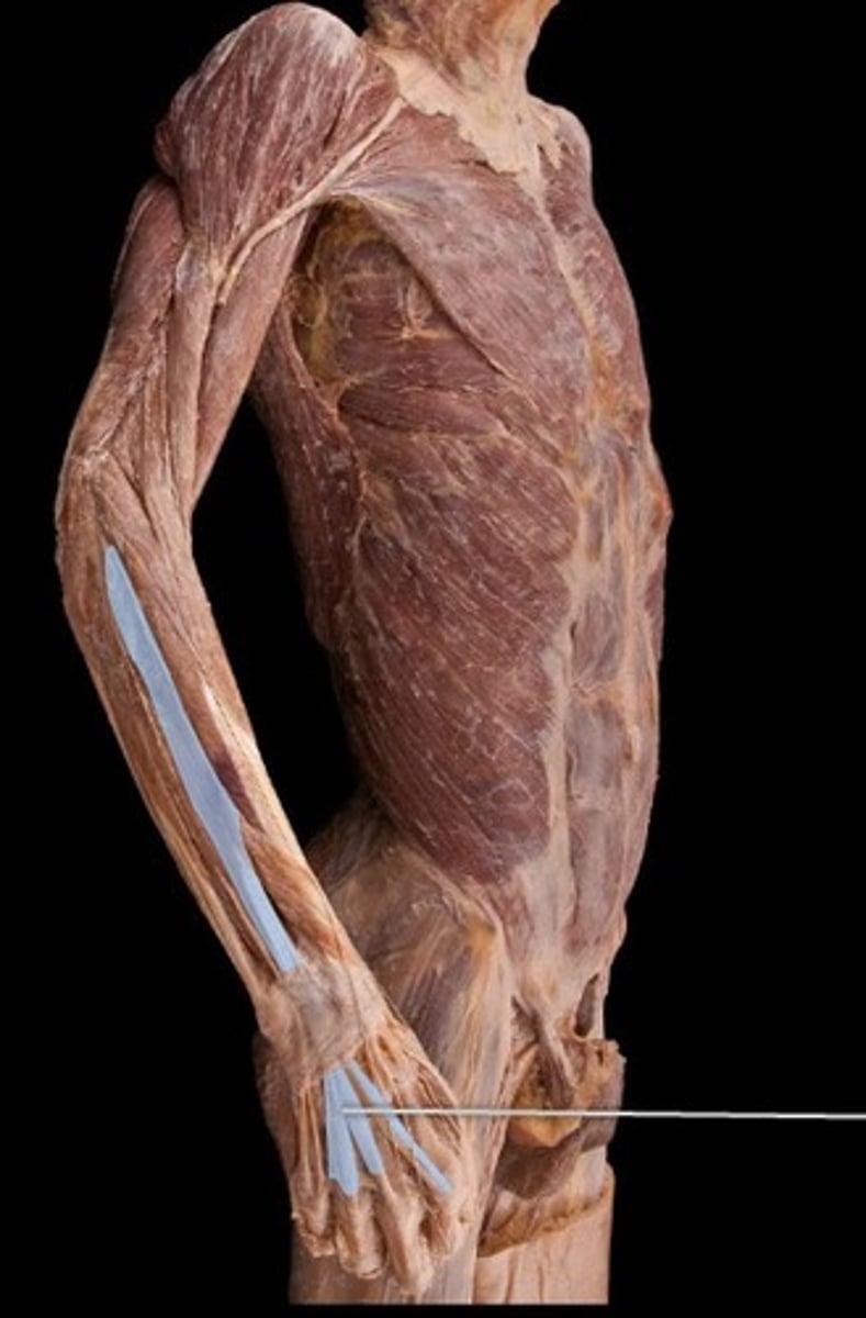 <p>What muscle is this?</p>