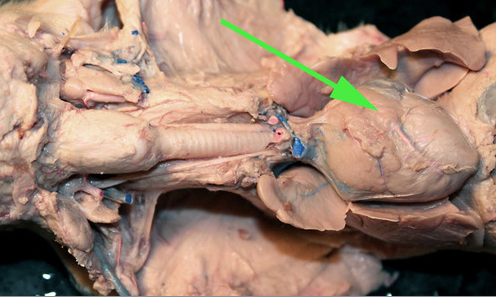 <p>The organ marked by the green arrow is part of the <strong>THYMUS </strong>gland</p>