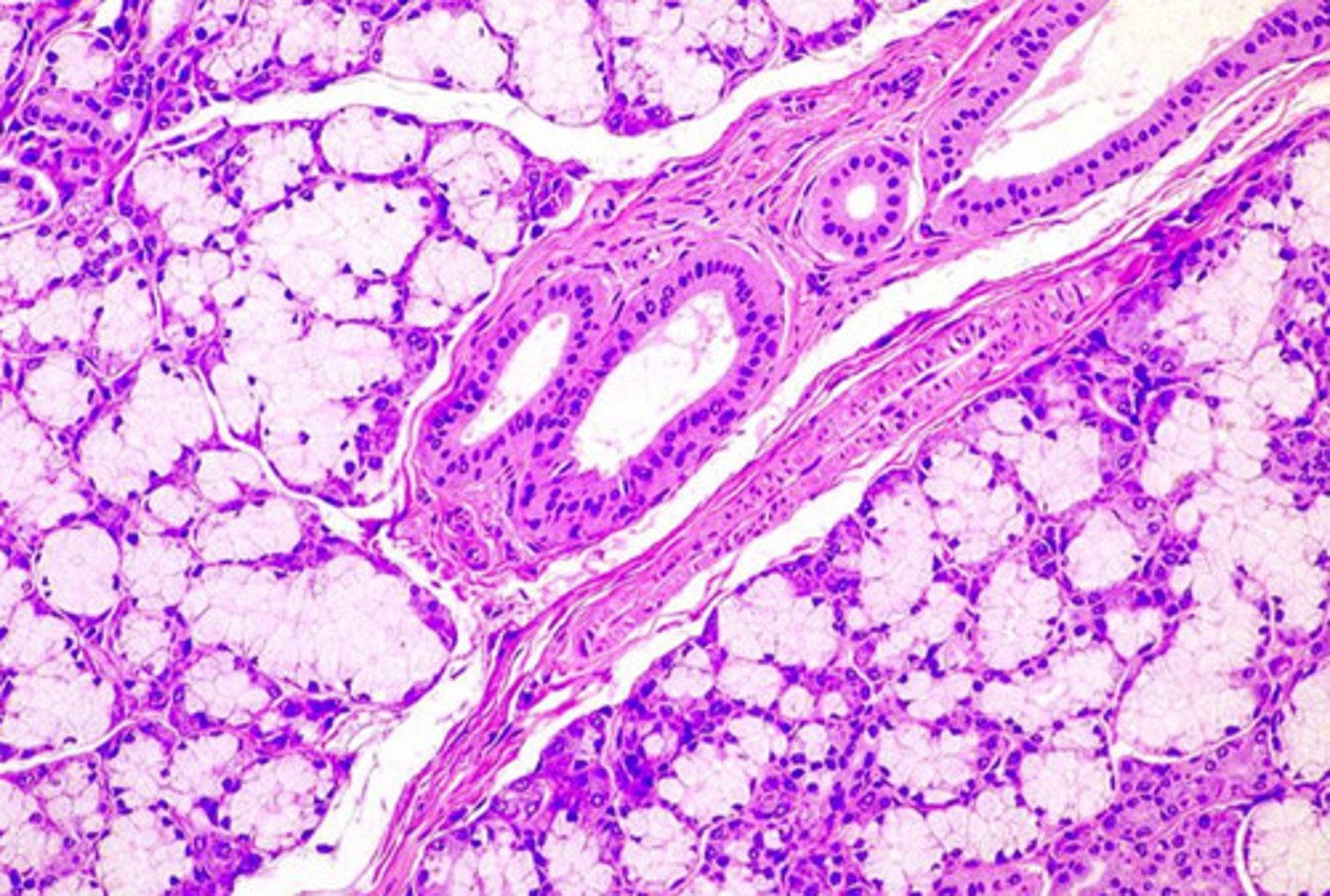 <p>sublingual</p><p>- mucous cells (poorly stained w/ flattened nucleus) outnumber acinar cells</p>