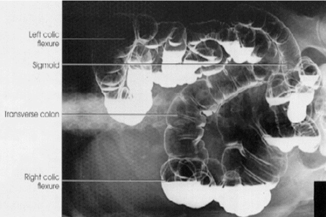 <p>What contrast procedure was performed to produce this image? </p><p>What position was performed to produce this image?</p>