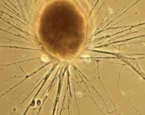 <p>Prolungamenti citoplasmatici che si anastomizzano tra loro</p>