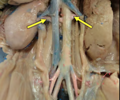 <p>What is the arrow pointing to? What’s it function? </p>