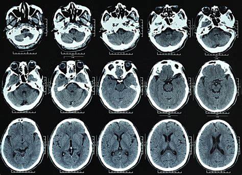 <p>head traumas and fractures; x-ray photos</p>