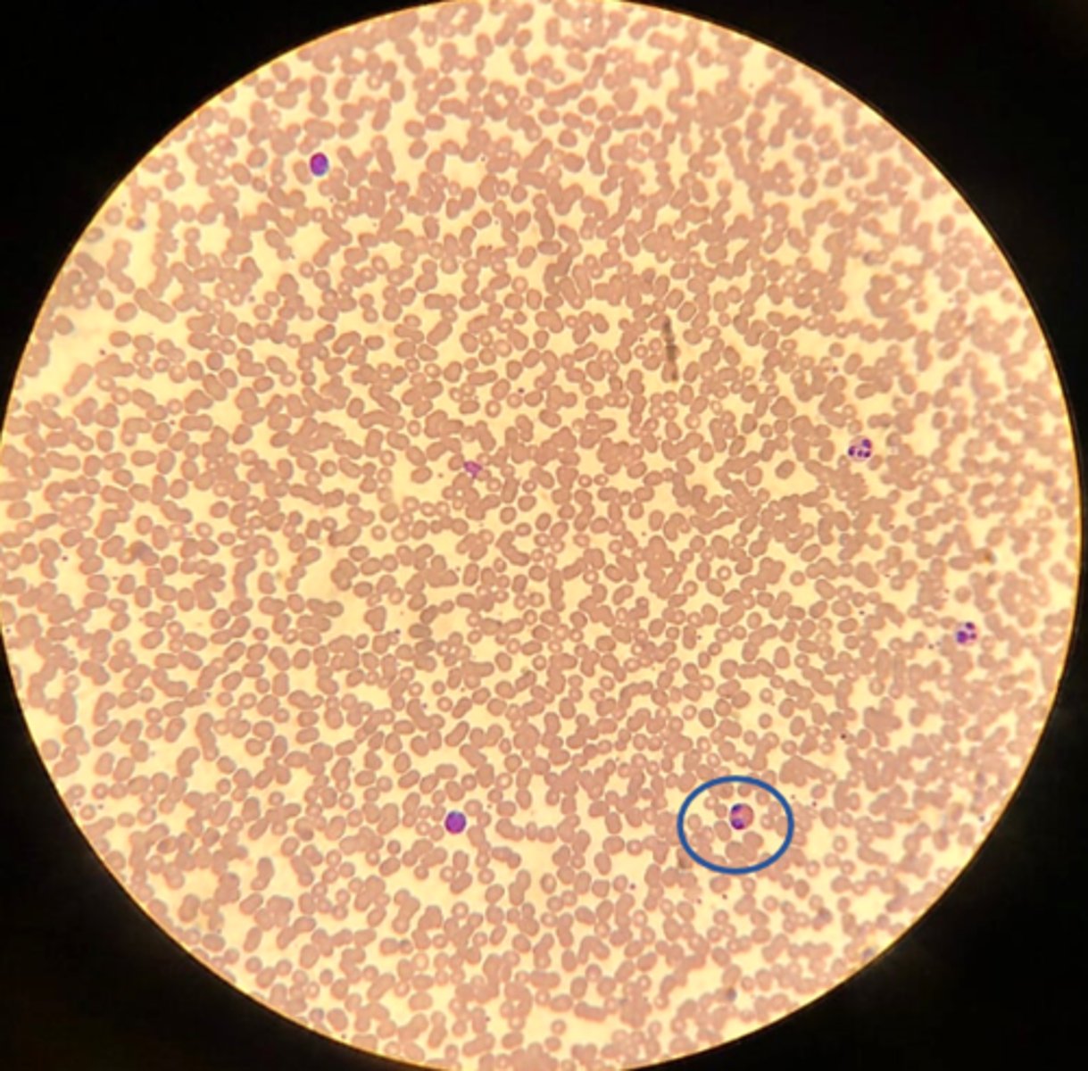 <p>Name the white blood cell</p>