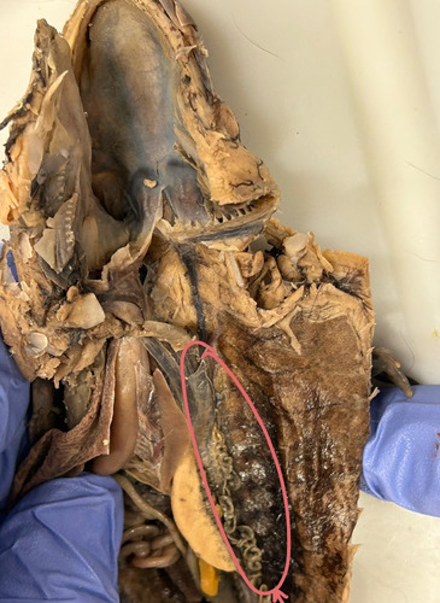 <p>What is the structure highlighted in pink?</p>