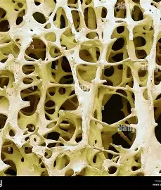 <p>spongey bone tissue </p>