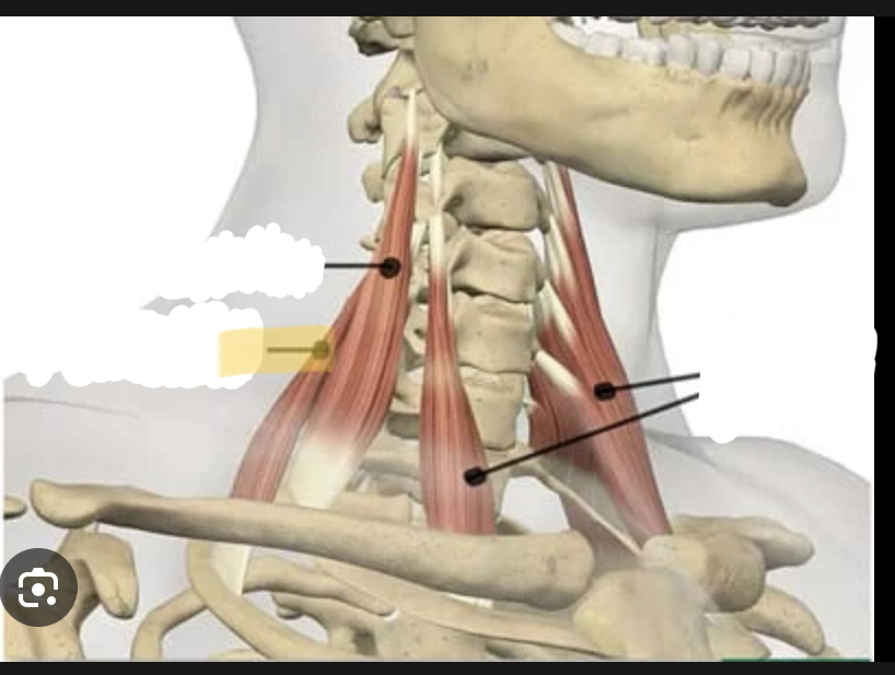 <p>Identify the highlighted muscle</p>