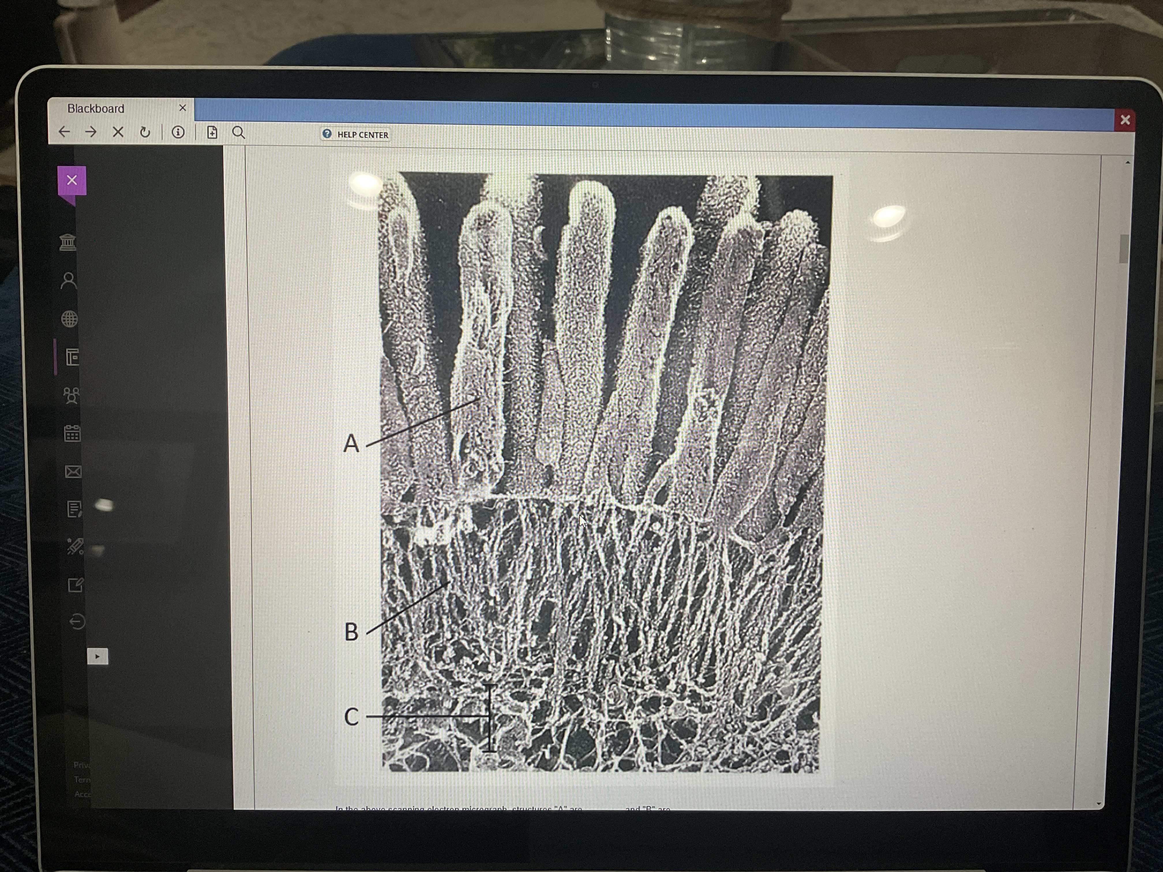 <p>in the above scanning electron micrograph, structures A are ___ and B are ___</p>